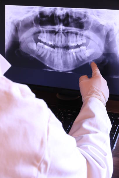 Best Broken or Chipped Tooth Repair in Big Pine, CA