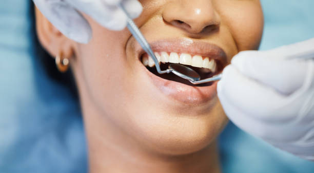 Professional Emergency Dental Service in CA